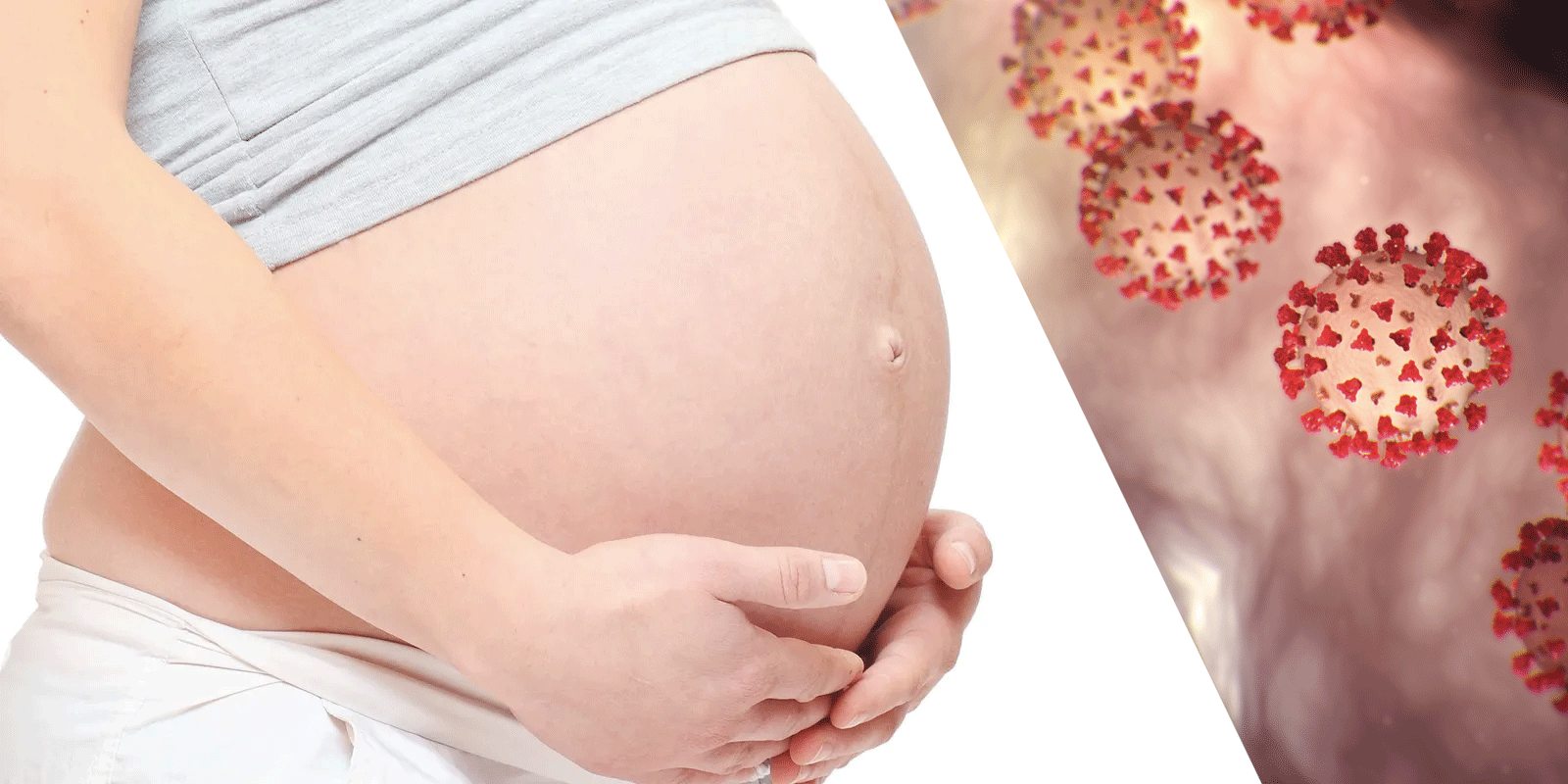 Coronavirus precautions for pregnant moms